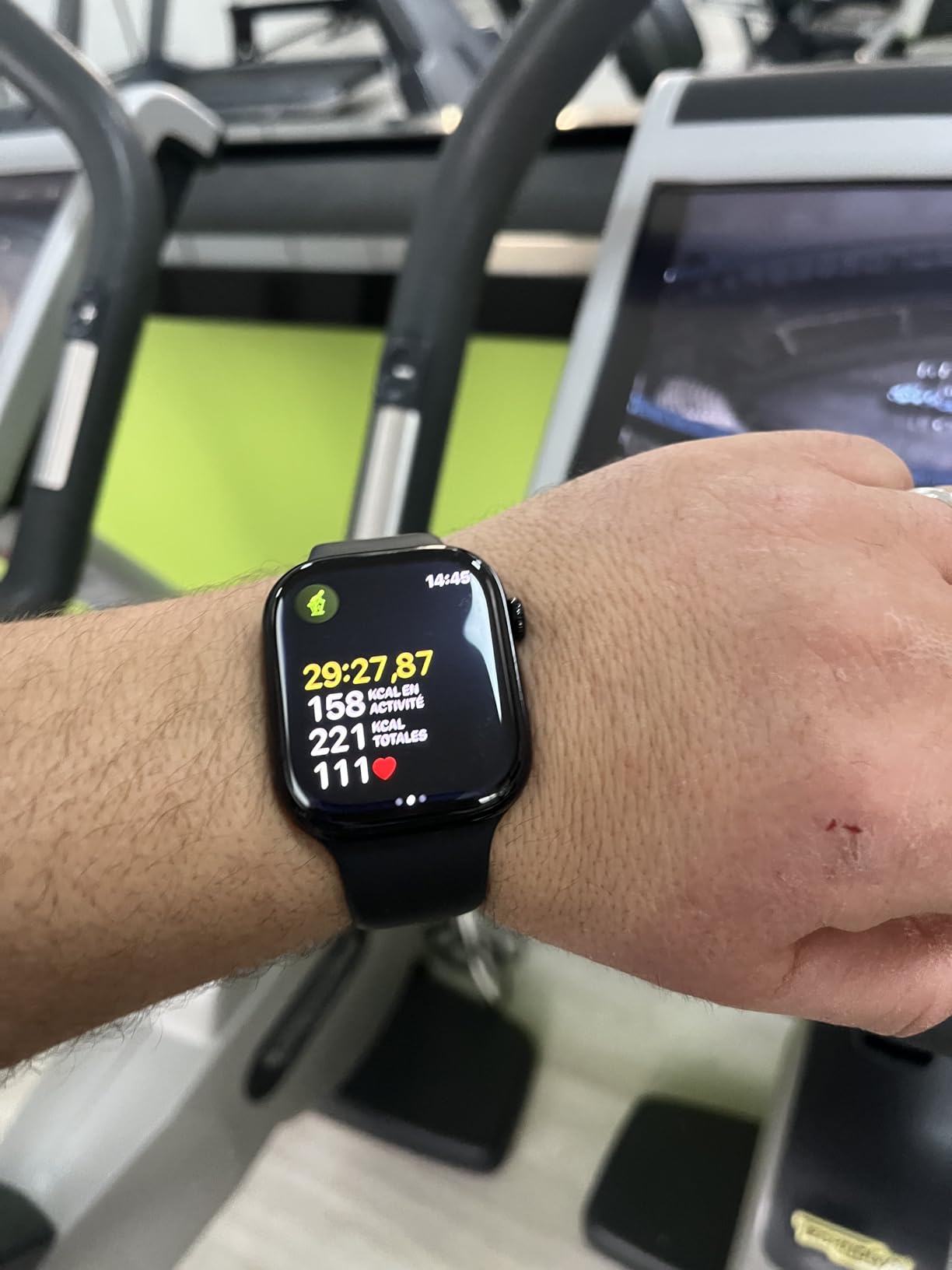 Apple Watch Series 11 GPS 46 mm Diamantschwarz S/M